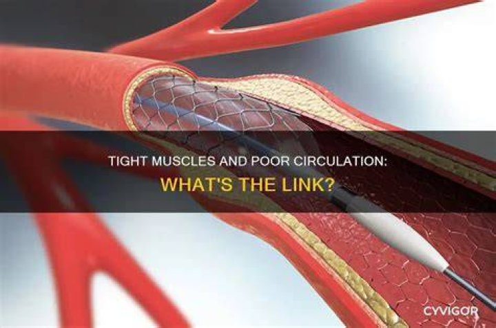 Are tight muscles bad