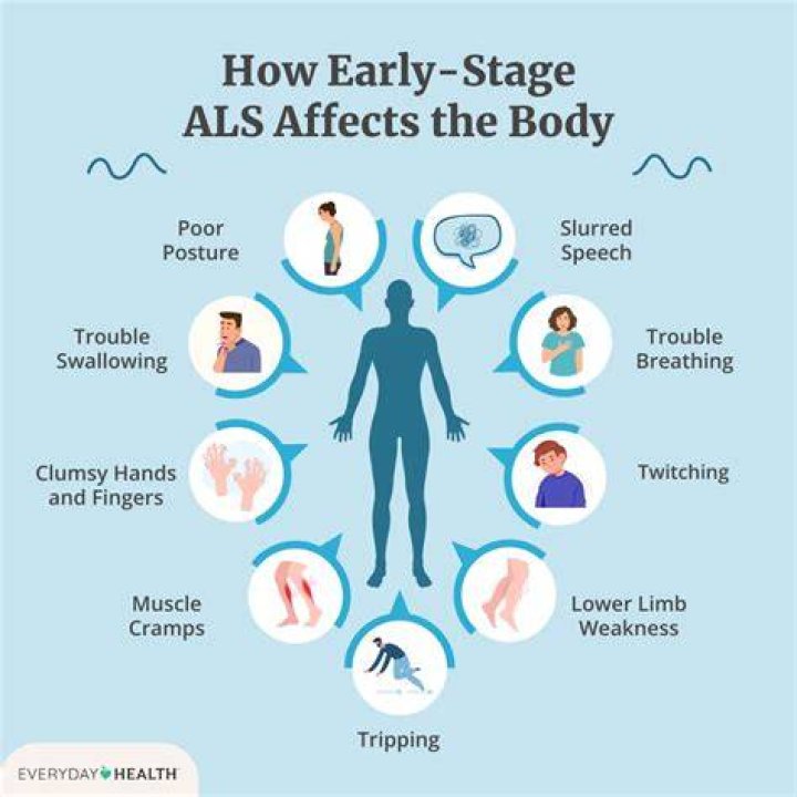 Can ALS start in toes