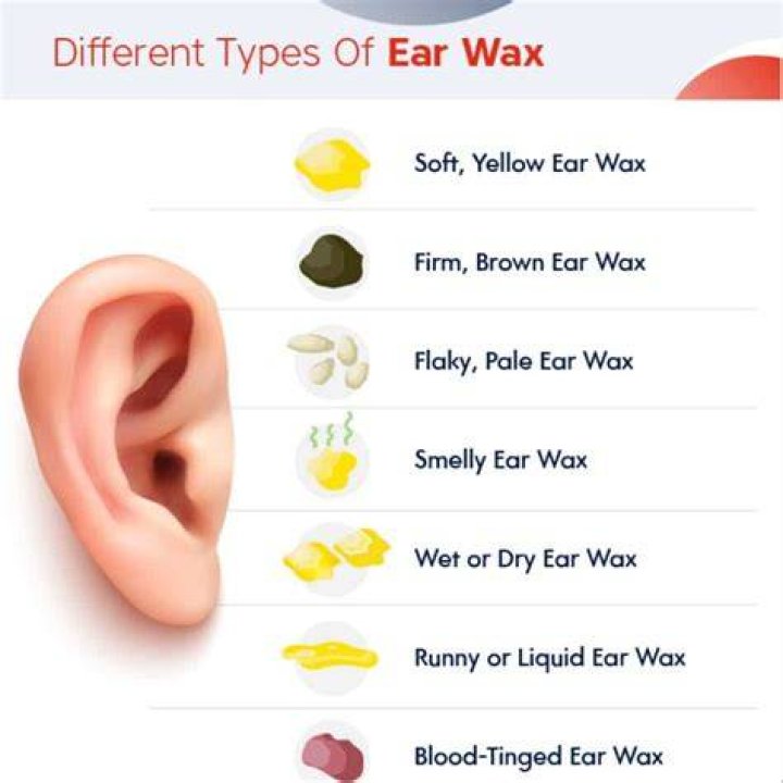 Can ear wax harm you