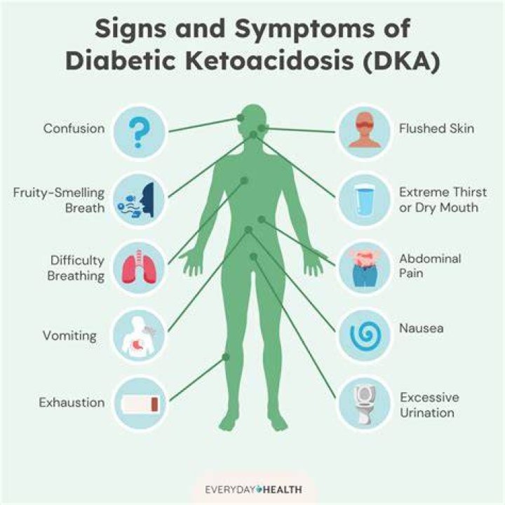 Can the flu cause DKA