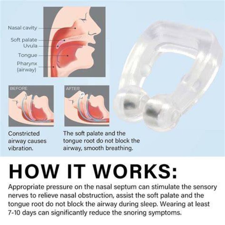 Does snore stop work