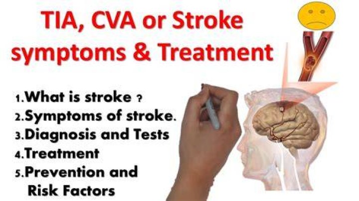 Does Tia lead to CVA