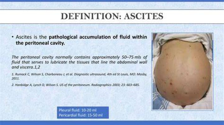 How ascites is formed