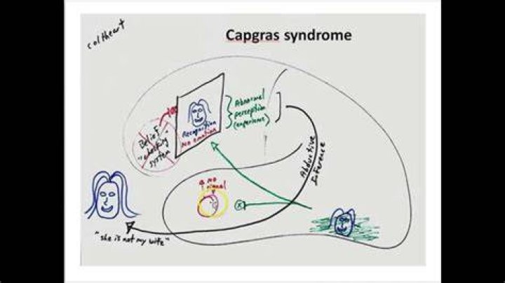 How common is Capgras