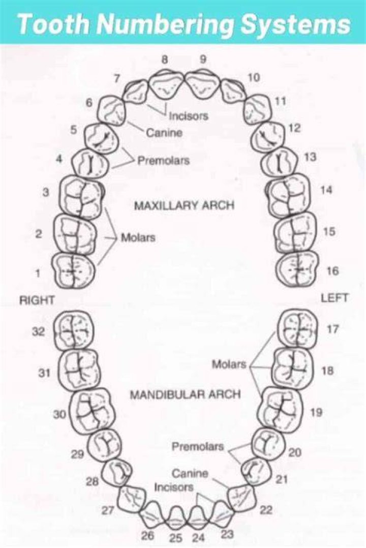 Is 17 a wisdom tooth