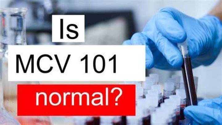 Is an MCV of 101 high