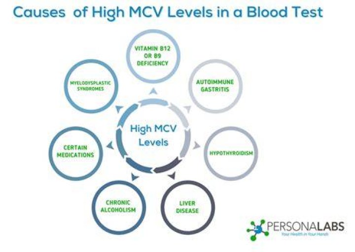Is an MCV of 99 high