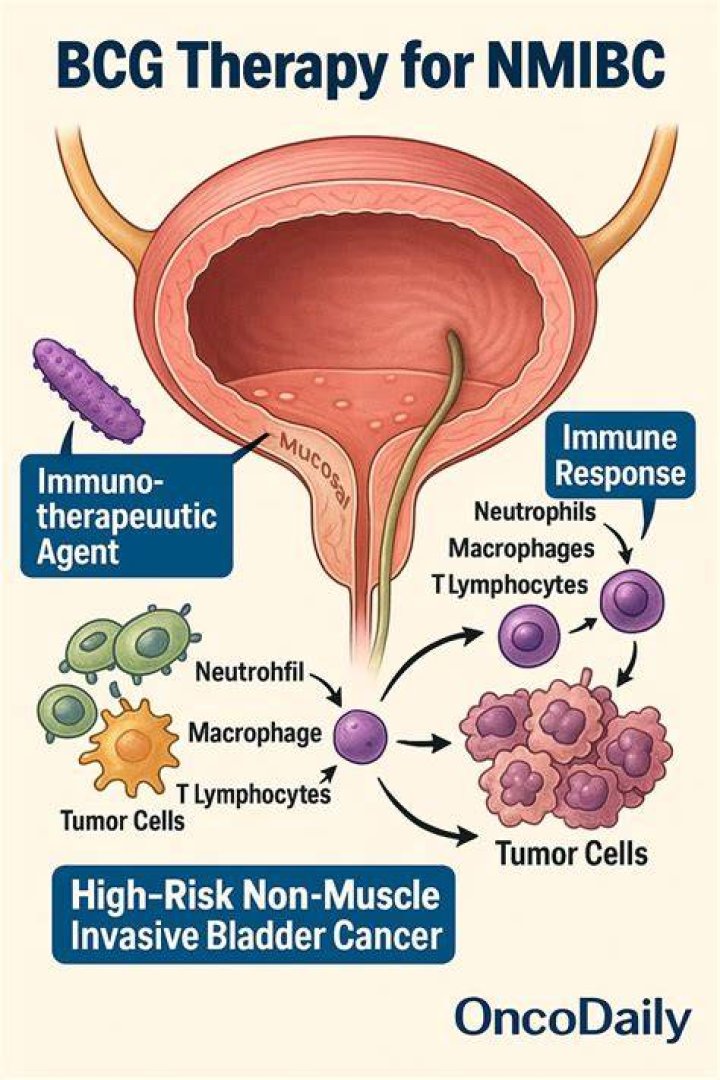 Is BCG a chemotherapy