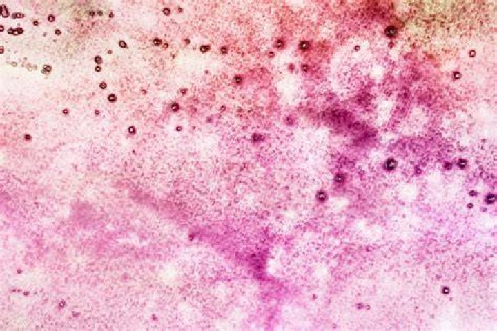 Is pink mold harmful