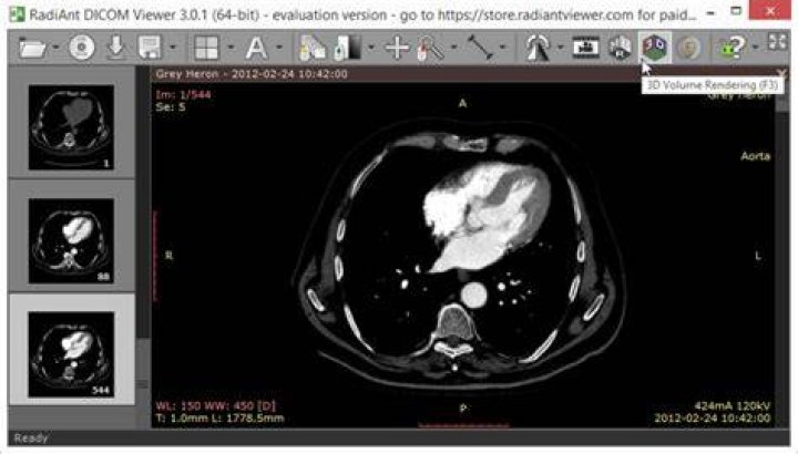 Is RadiAnt DICOM free