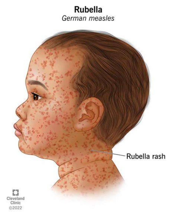 Is rubella segmented
