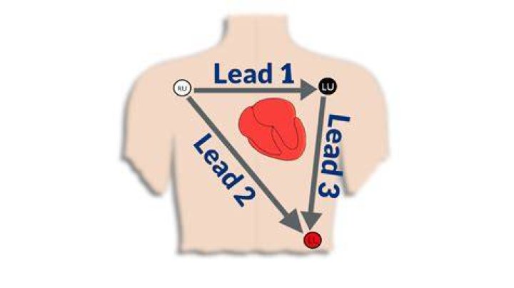 Is there a 3 lead ECG