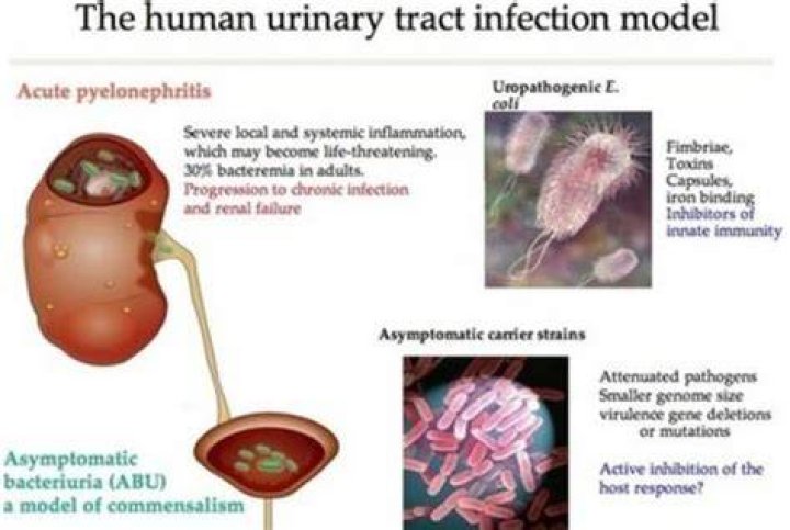 Is urosepsis serious