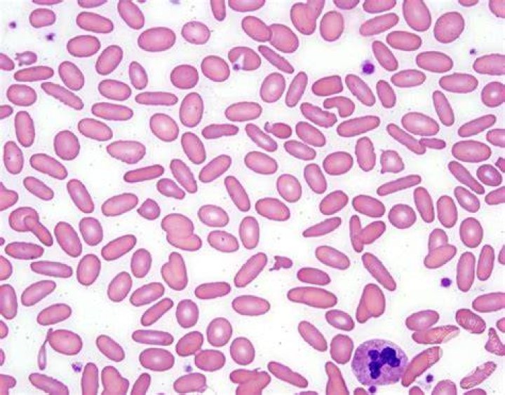 What are Elliptocytes