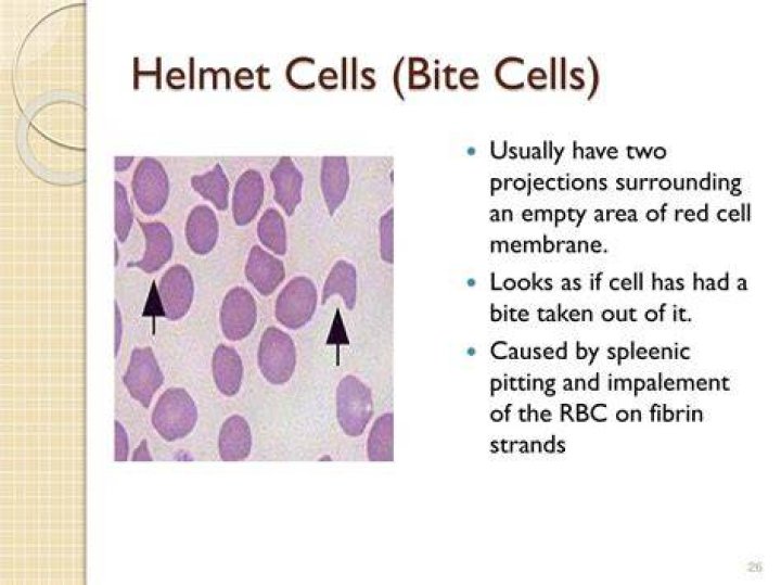 What are helmet cells