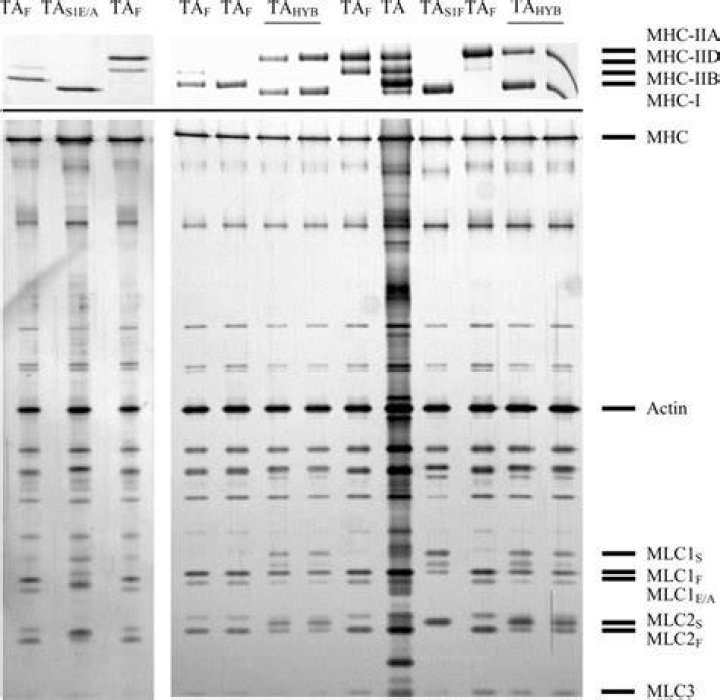 What are MHC isoforms