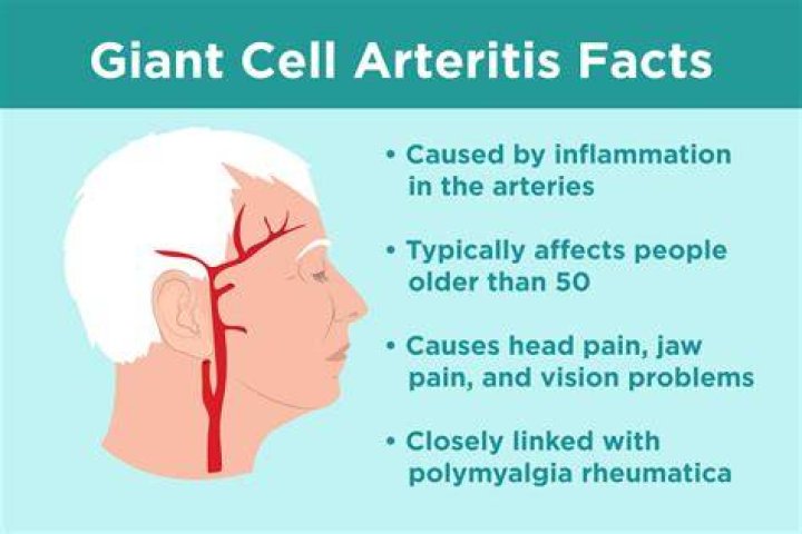 What causes arteritis