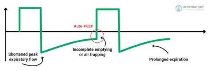 What causes auto peep