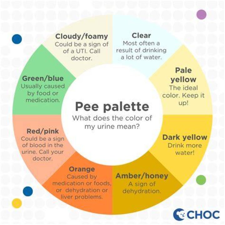 What color Is Pee bad