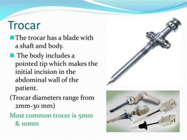 What does a trocar do