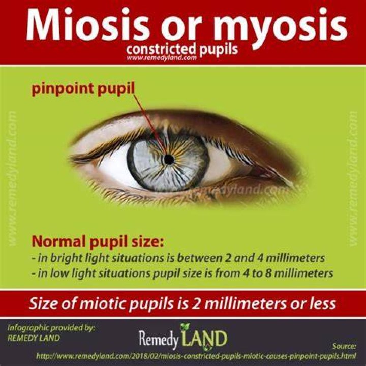 What does Miotic mean