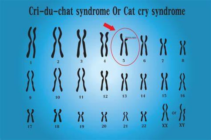 What is a cri du chat