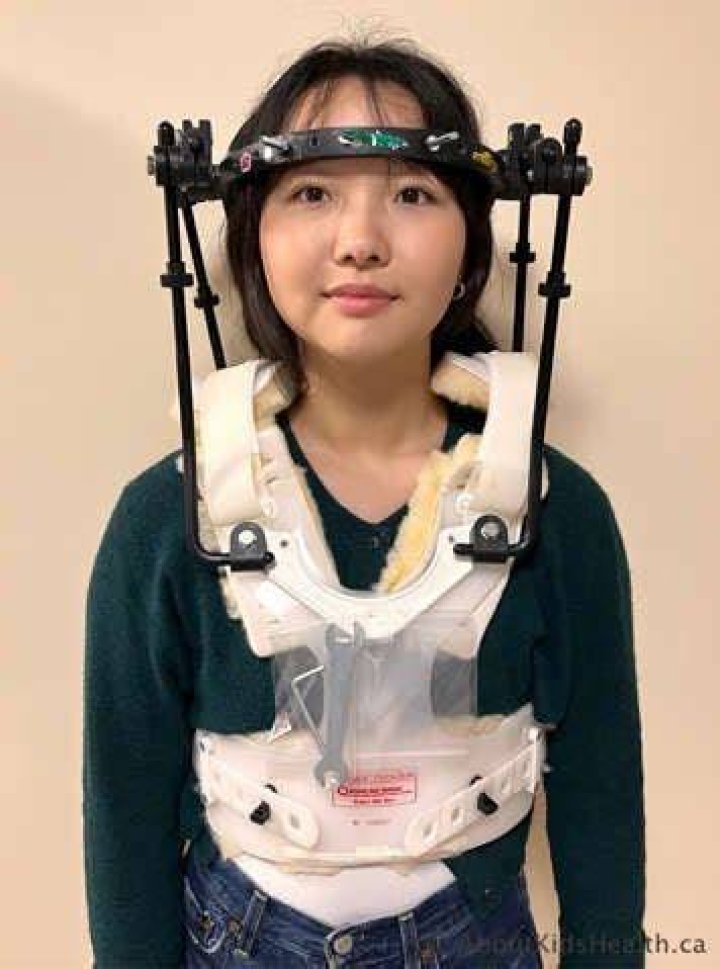 What is a halo device
