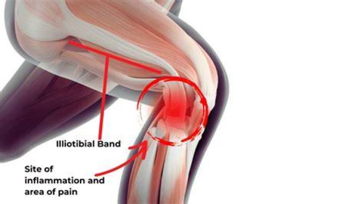 What is an ITB injury