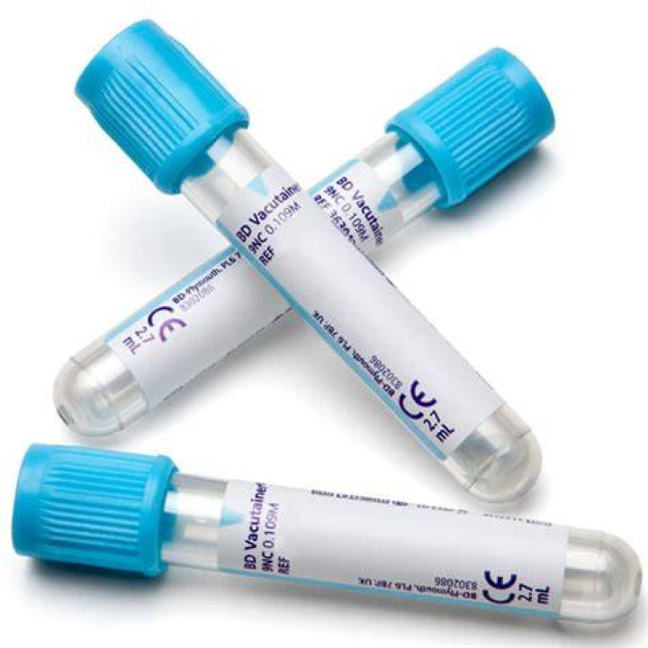 What is BD vacutainer