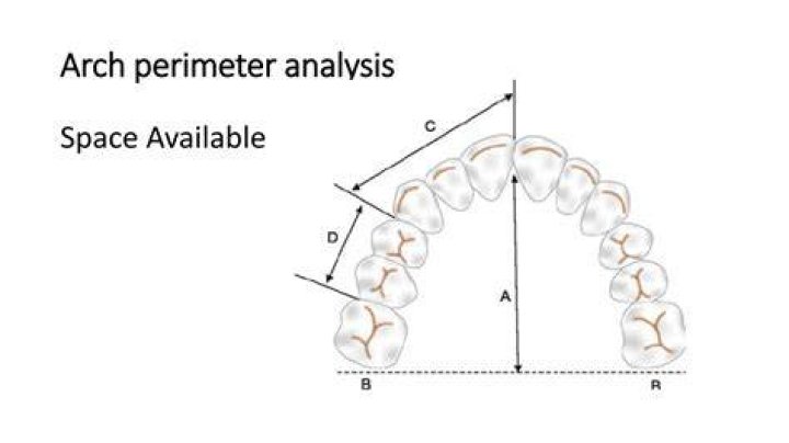 What is cast analysis