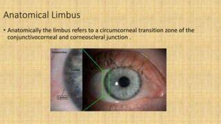 What is Circumcorneal