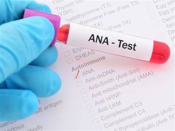 What is Fana lab test