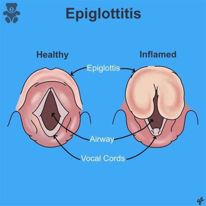 What is glottal shock