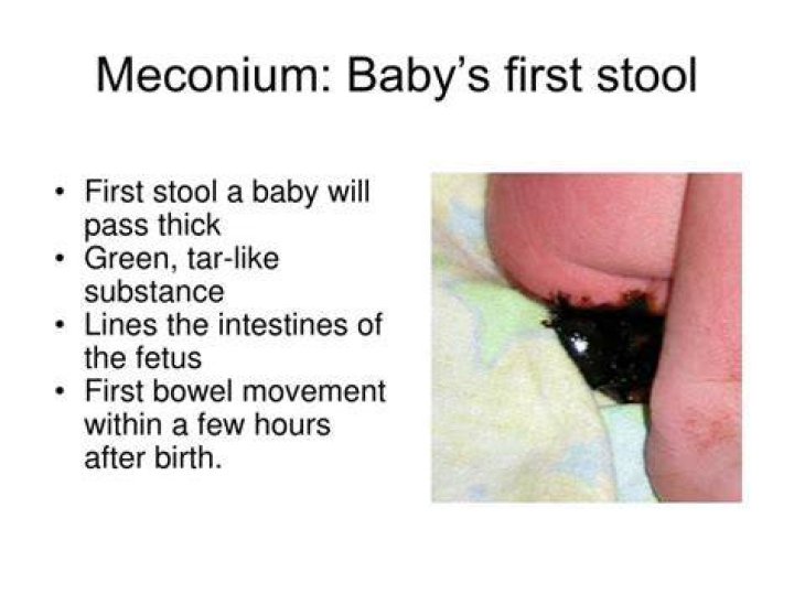 What is meconium poop