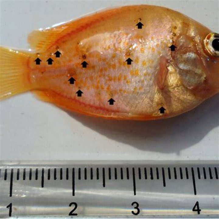 What is Metacercariae