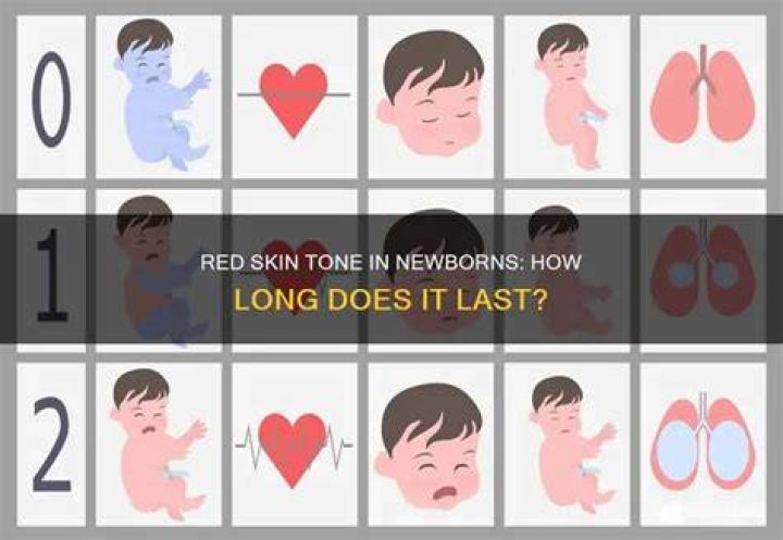 What is newborn tone