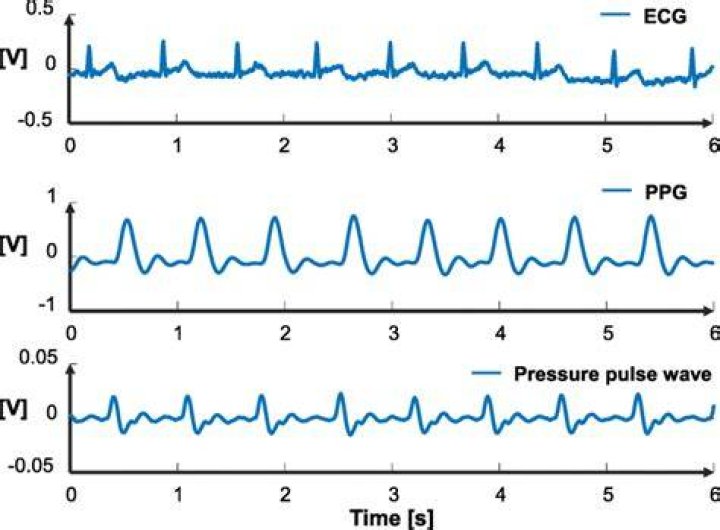 What is ppg pressure