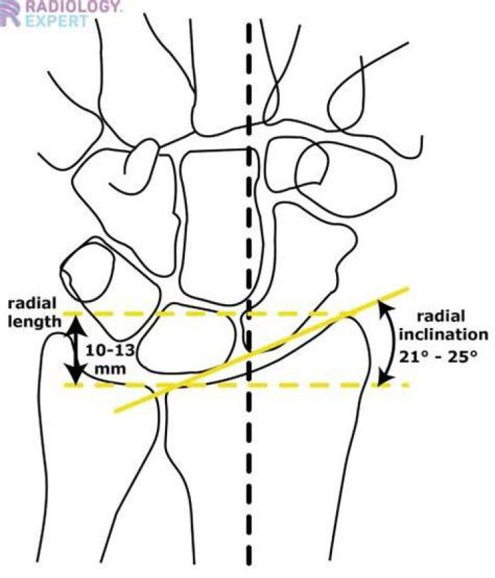 What is radial length
