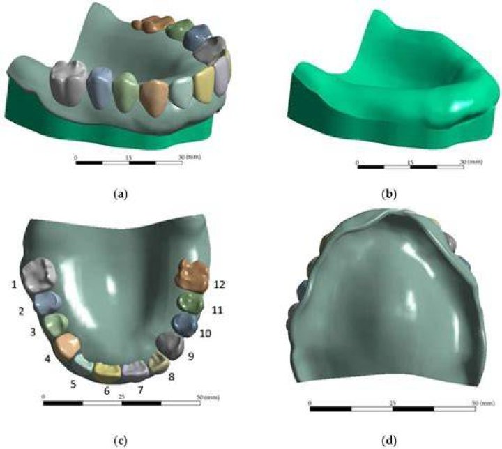 What is RCD of teeth
