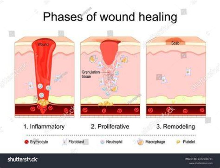 What is repair tissue
