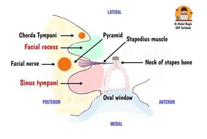 What is sinus tympani