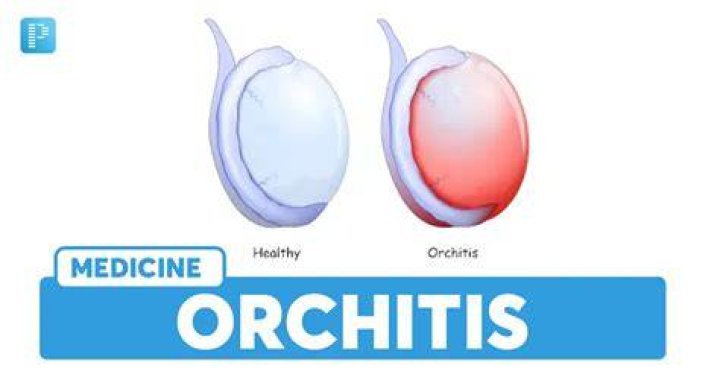 What is the orchitis