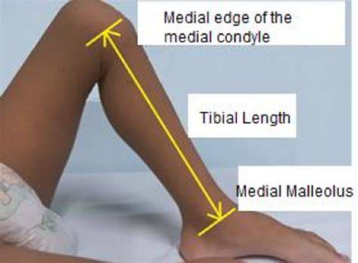 What is tibial length