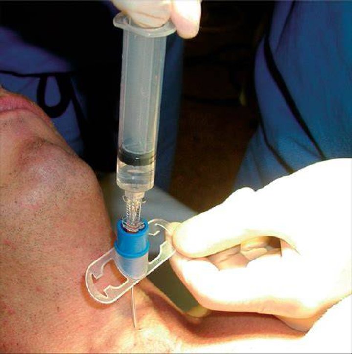 What is Transtracheal