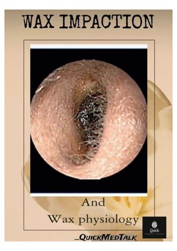 What is wax impaction