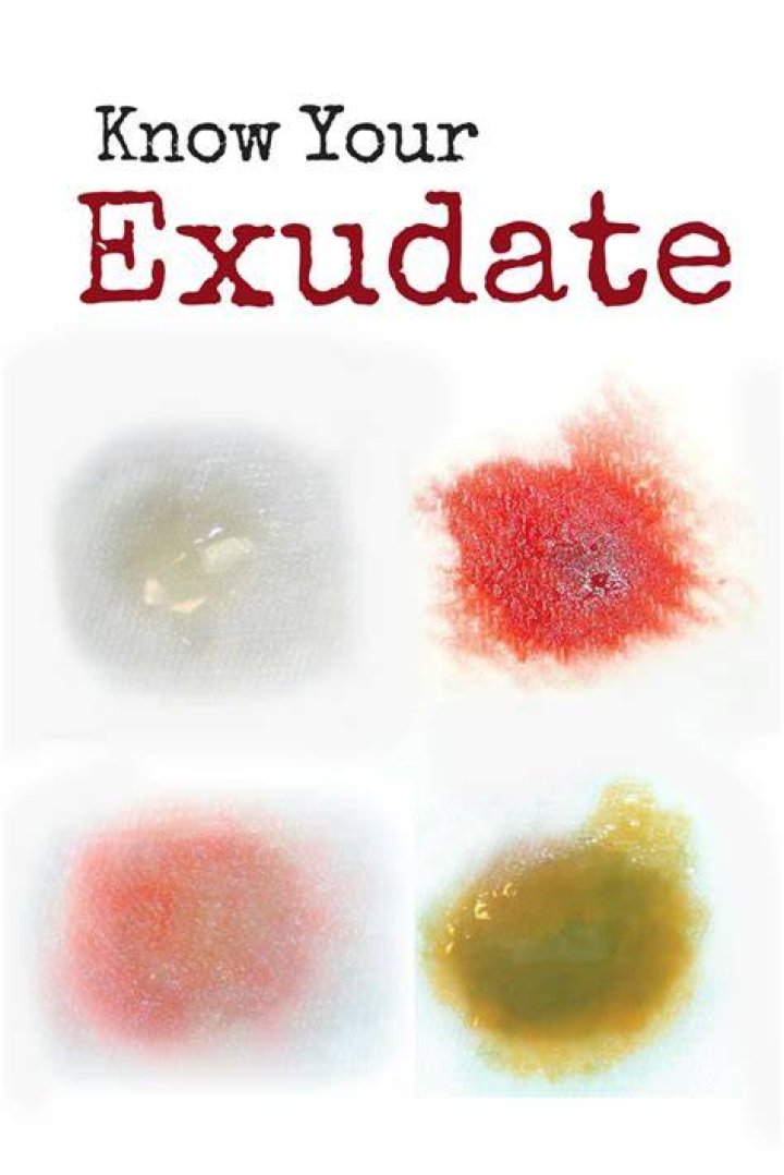 What is wound exudate