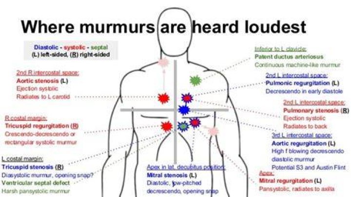 What murmur radiates