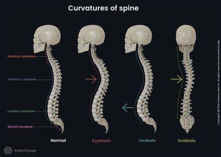 What spine looks like