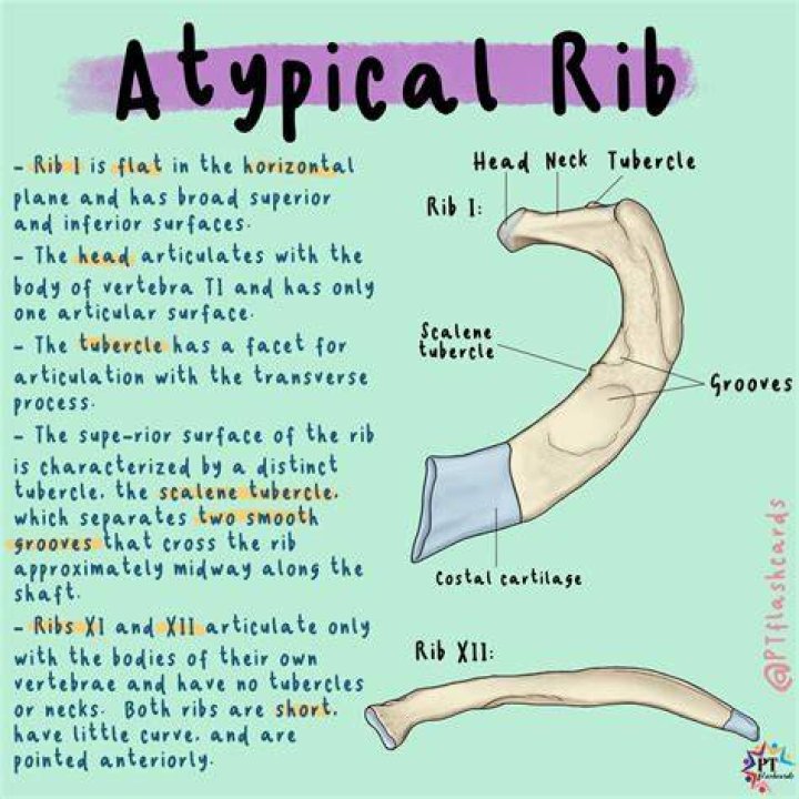 Why is rib 2 Atypical